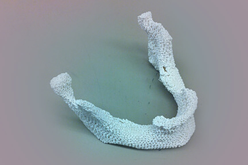 The Search for Better Bone Replacement: 3-D Printed Bone with Just the Right Mix of Ingredients